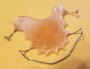Paul's orthodontia retainer from the mid-1970s. Yes, I still have it!